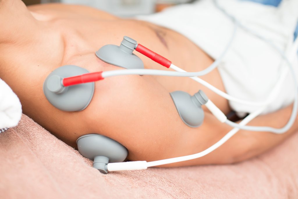 Electromyostimulation