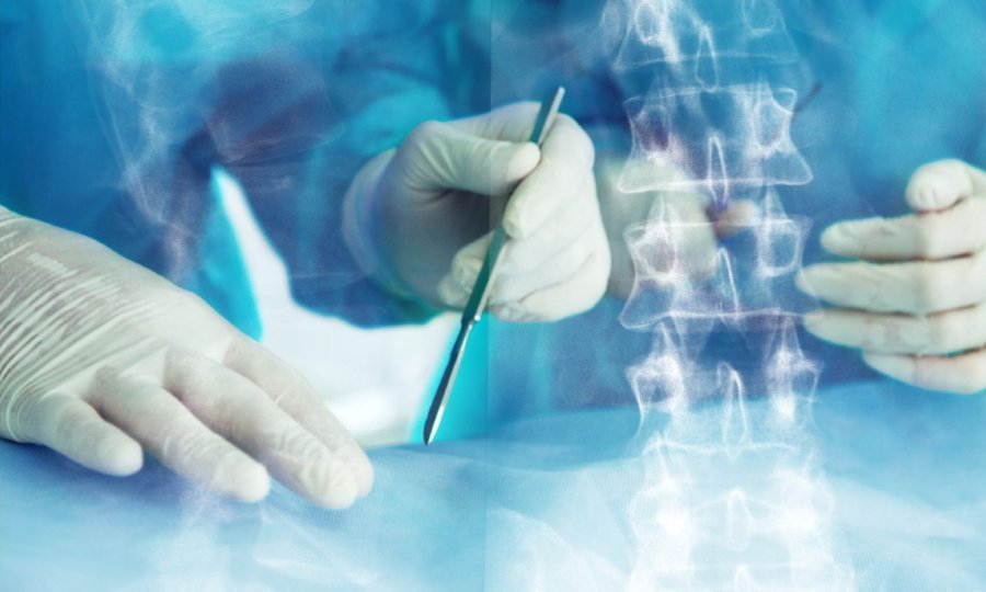 Expert Thoracic Spine Surgery Rehab