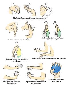 Exercises for Recovery After an Elbow Fracture