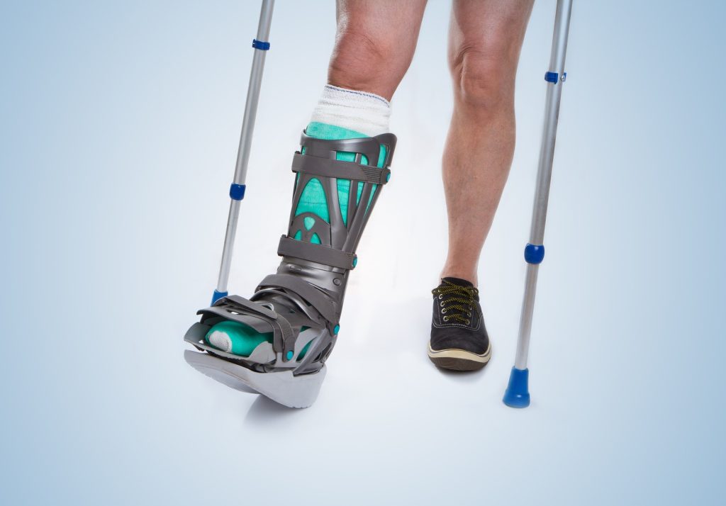 Rehabilitation After Tibial Fracture