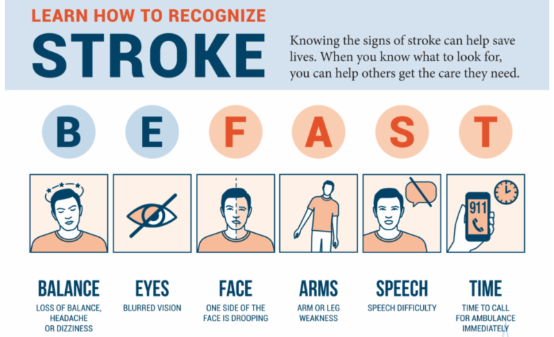 stroke symptoms 