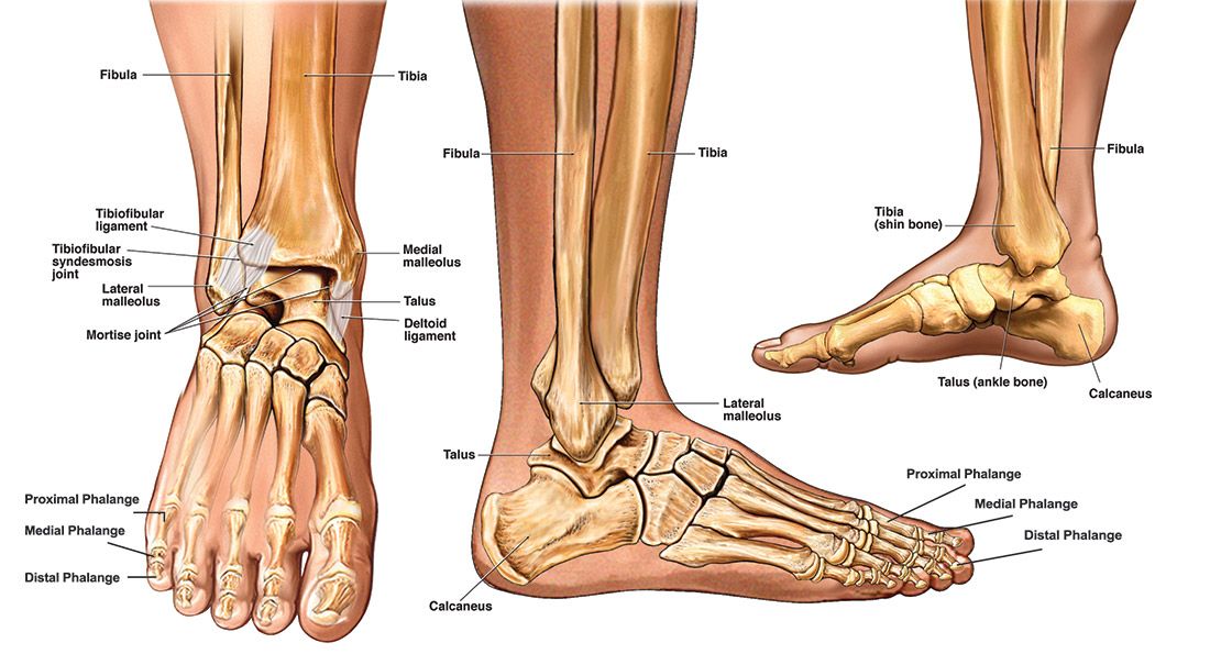 Types of Fractures in Broken Ankles